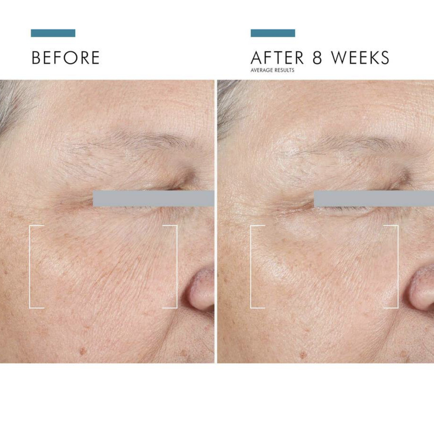 美容液 BEAUTY LINE anti aging 15ml Lift Eye Cream | NUXE